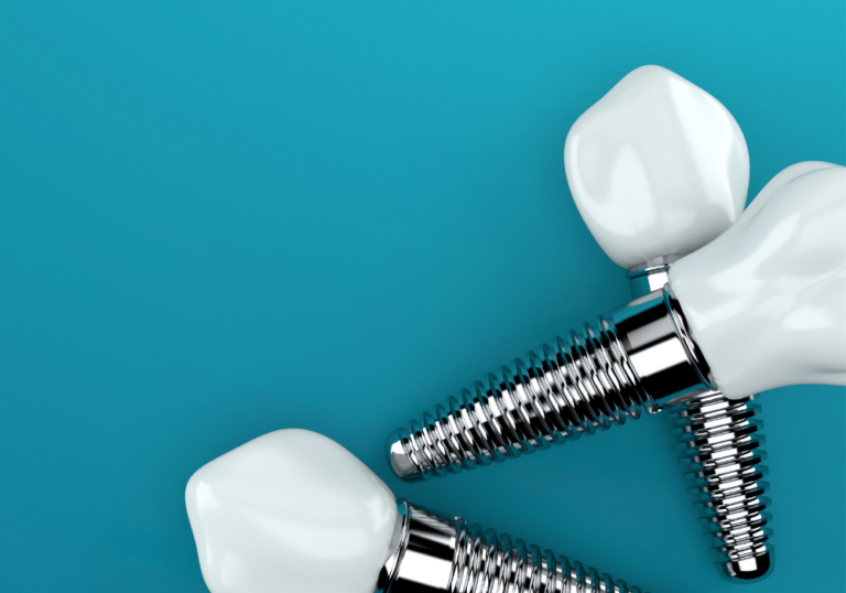 Three dental implants displayed against a blue background, each featuring a metal screw-like base and a white ceramic crown resembling a natural tooth.